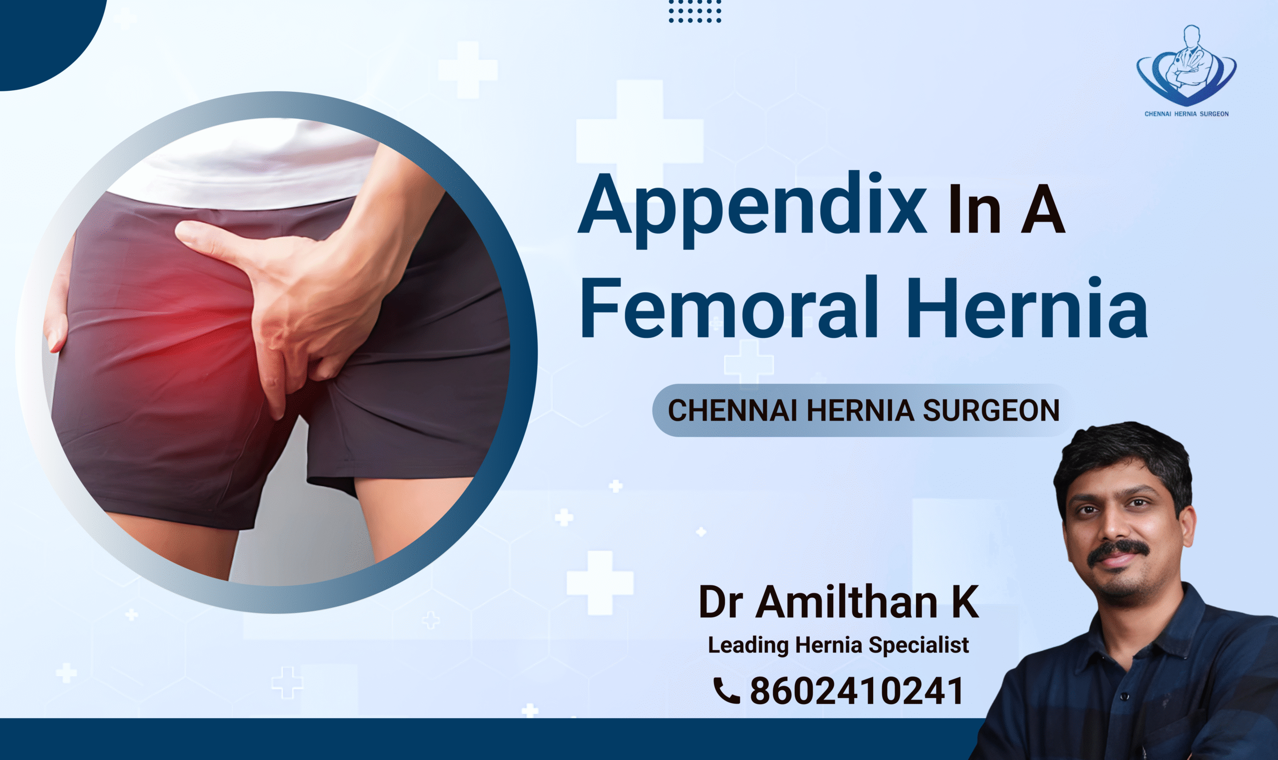 Appendix in a Femoral Hernia